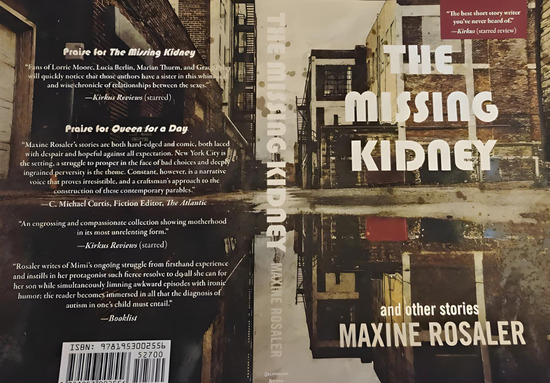 The Missing Kidney and other stories 